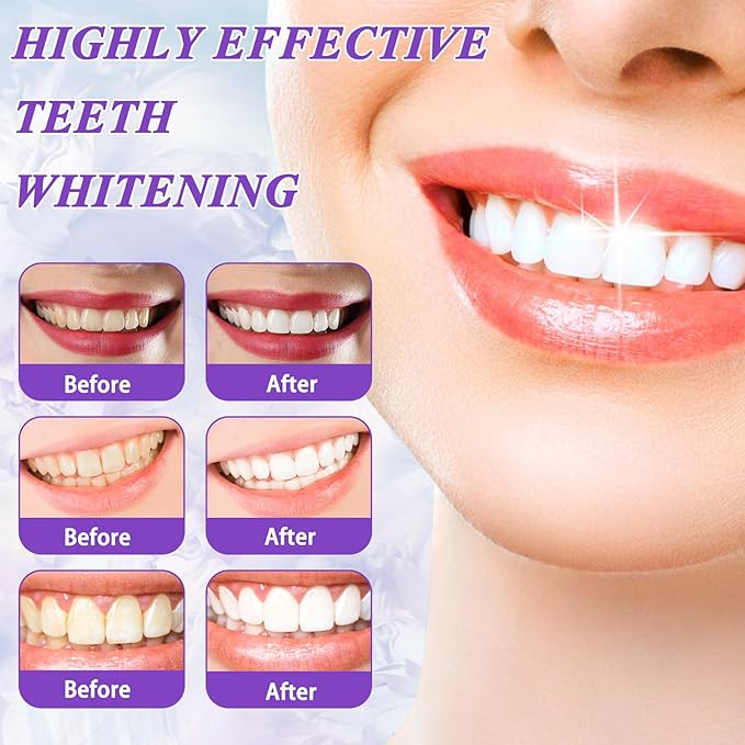 Pasta de Dientes Blanqueadora Morada – Colour Corrector Dental Obsessive