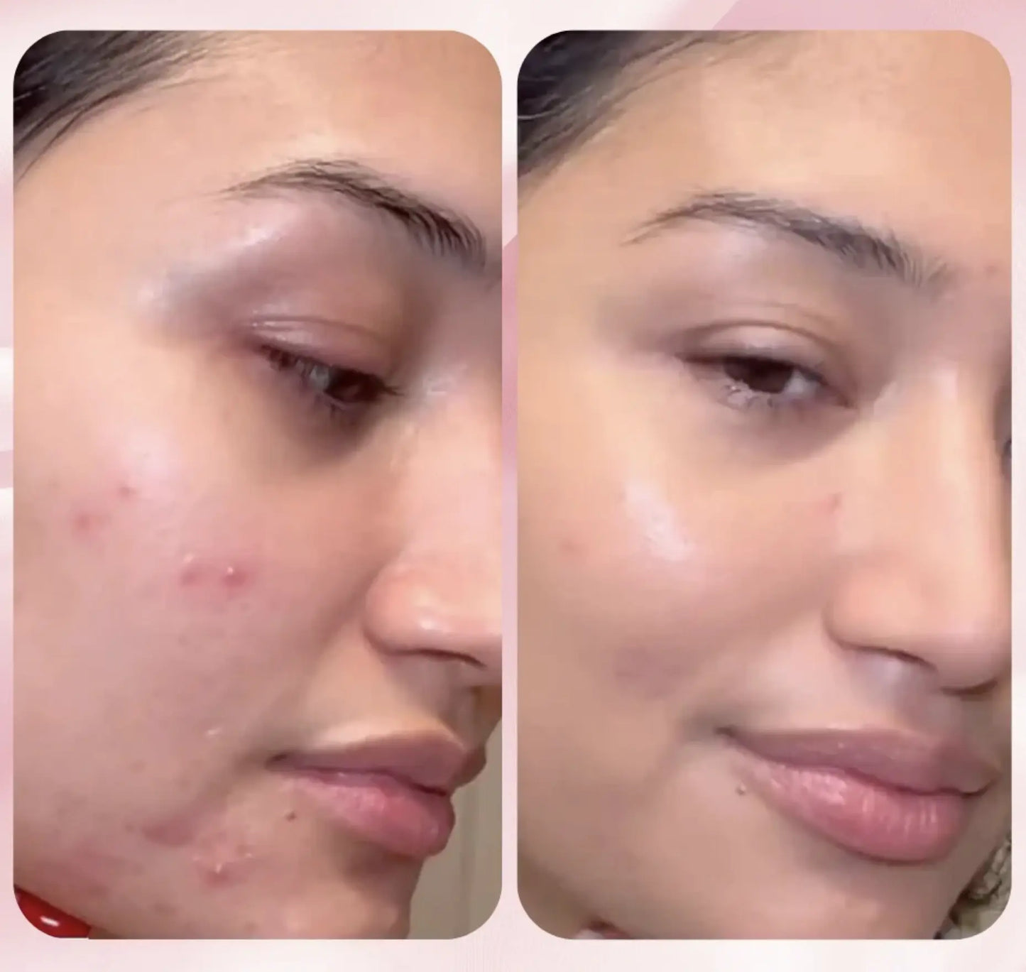 Collagen Facial Mask