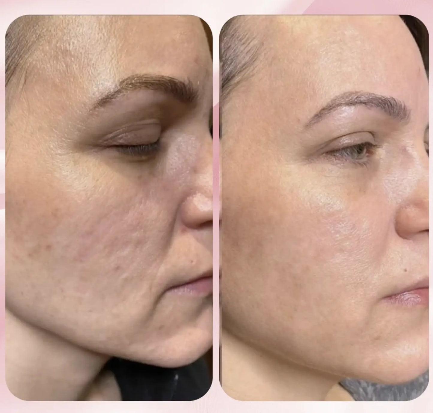 Collagen Facial Mask