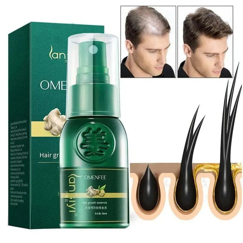 ShougaGRO spray para el crecimiento del cabello