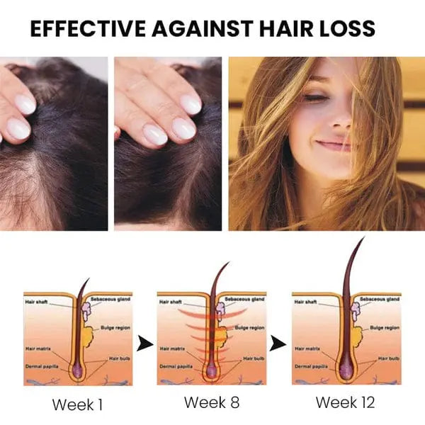 ShougaGRO spray para el crecimiento del cabello