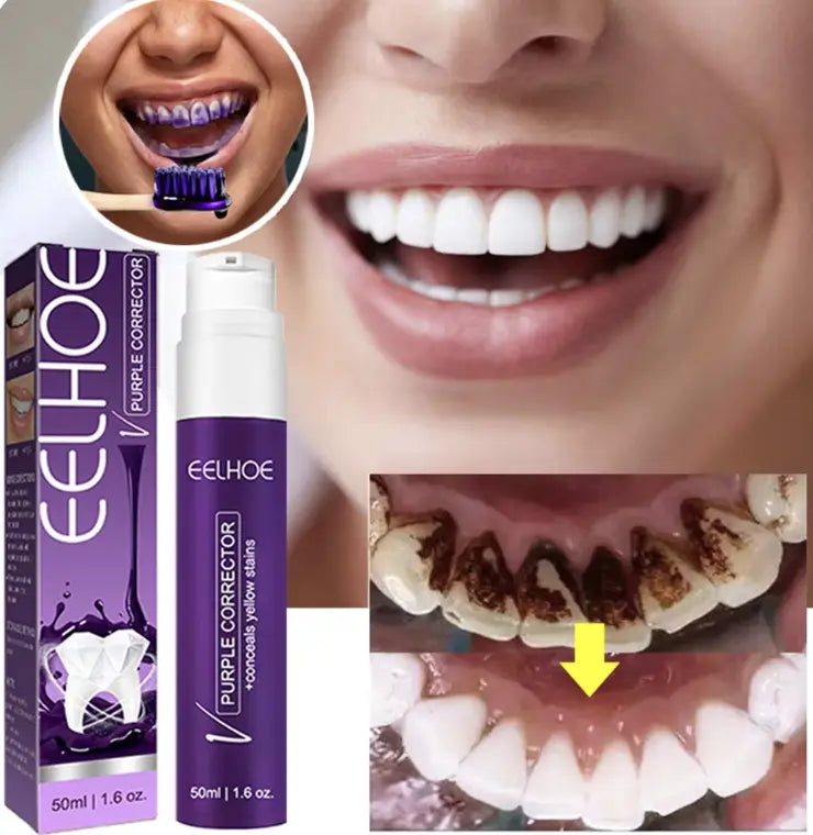 Whitening Toothpaste Teeth Cleaning