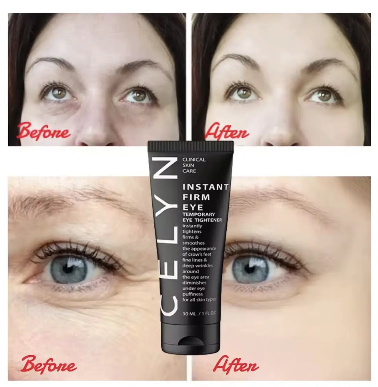 Crema para los ojos